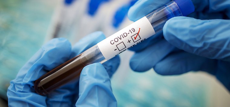 Еще 29 человек пополнили статистику по коронавирусу в Островском районе