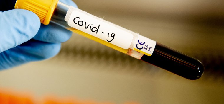 На 14 увеличилось число заболевших COVID-19 в Островском районе