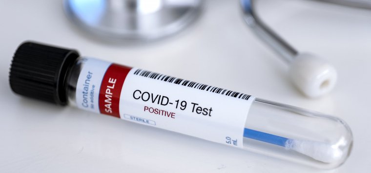 Еще 5 случаев COVID-19 выявили в Островском районе