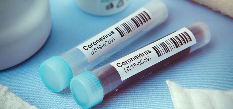 Число случаев заражения коронавирусом в Островском районе превысило 900