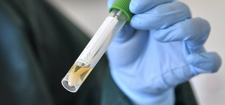 Число случаев коронавируса в Островском районе выросло до 59
