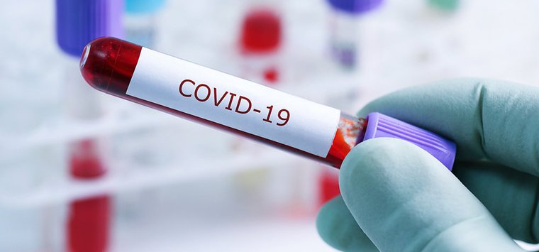 13 случаев COVID-19 выявили в Островском районе за неделю
