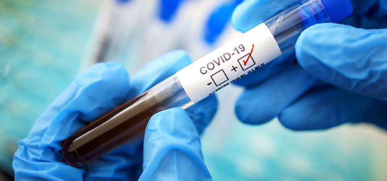 1700 превысило число заболевших COVID-19 в Островском районе