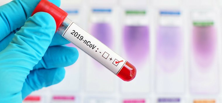 30 новых случаев COVID-19 добавилось в статистику Островского района