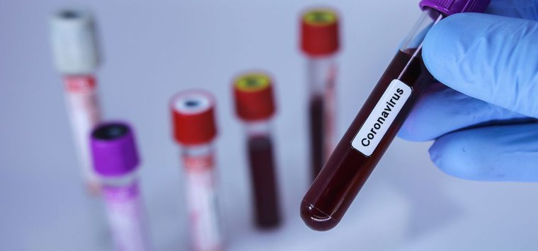 Еще два человека заразились коронавирусом в Островском районе